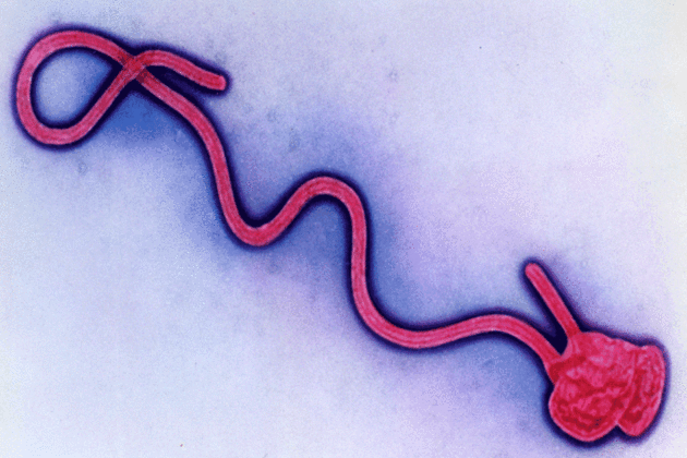 UK specialists head to Congo as concerns about Ebola increase Ebola hemorrhagic fever
